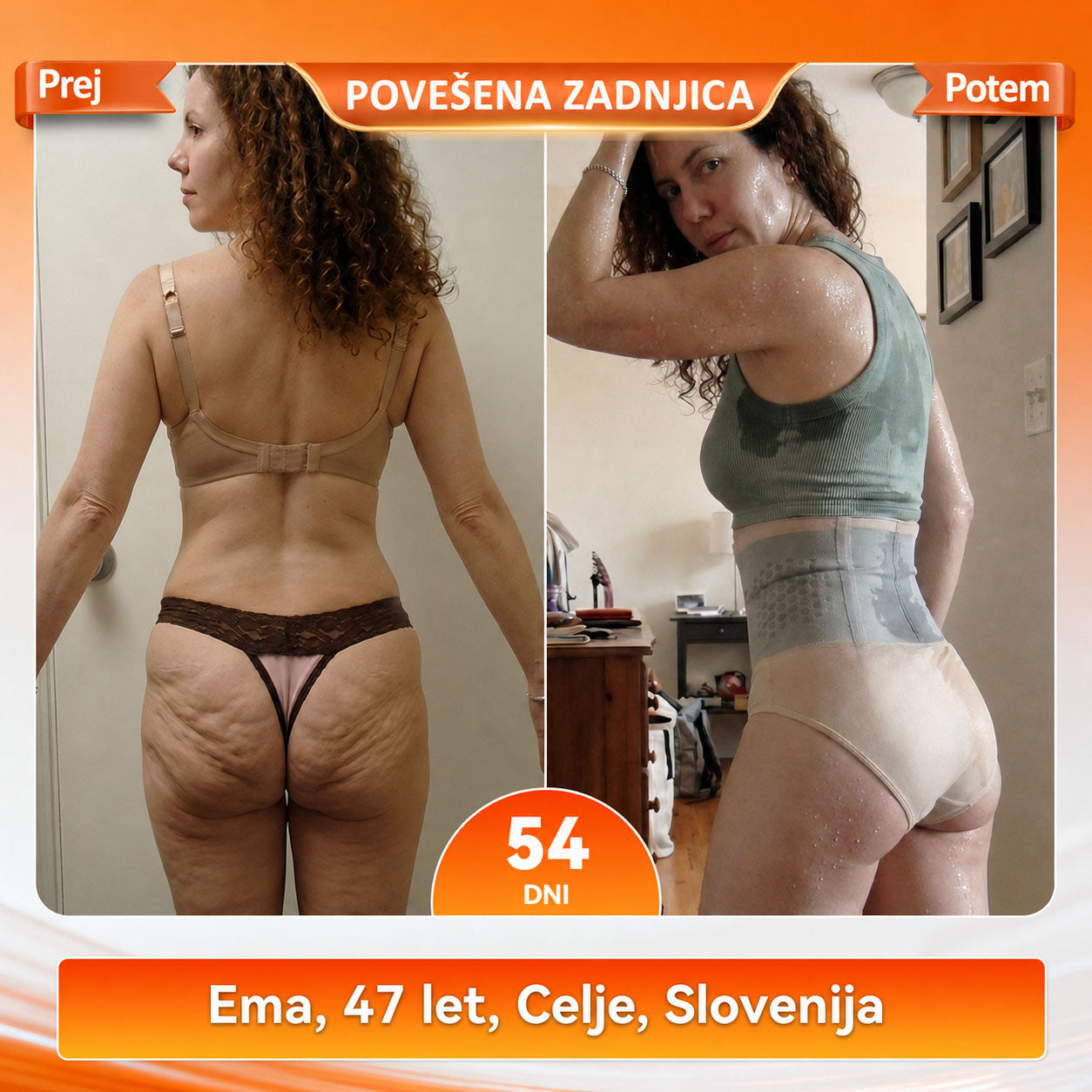 Oficiálny značkový butik | 👑𝑷𝑬𝑨𝑹𝑳𝑴𝑶𝑶𝑵® 2026 4 v 1 tvarujúce a spaľujúce kraťasy s mikročasticami z MORINGY IN BERBERÍNU